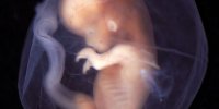 В Минздраве Тувы выразили обеспокоенность ростом «пропущенных» случаев патологий внутриутробного развития
