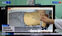 Кузбасские хирурги во главе с Орланом Ооржаком прооперировали девушку, у которой селезенка превысила в 15 раз норму