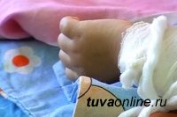 В Туве 10-месячный малыш опрокинул на себя чайник с кипятком